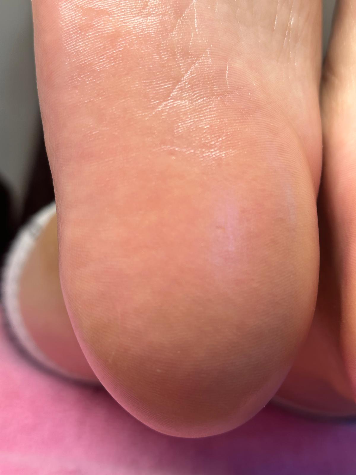 Nageldesign: professionelle fusspflege gepflegte ferse aus Kategorie fuße